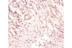 Immunohistochemistry of paraffin-embedded human kidney tissue using ABIN7174131 at dilution of 1:100 (SNRPA1 Antikörper  (AA 8-278))
