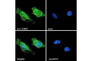 (ABIN570758) Immunofluorescence analysis of paraformaldehyde fixed HeLa cells, permeabilized with 0.