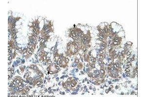 Image no. 1 for anti-Salt-Inducible Kinase 1 (SIK1) (N-Term) antibody (ABIN321003) (SIK1 Antikörper  (N-Term))