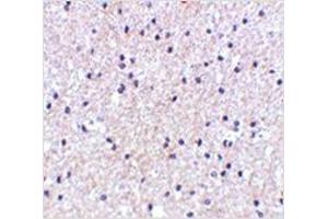 Immunohistochemistry of MORF4 in human brain tissue with MORF4 antibody at 5 μg/ml. (MORF4 Antikörper  (N-Term))