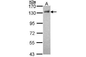 WB Image Sample (30 ug of whole cell lysate) A: Hep G2 , 7. (DDB1 Antikörper  (C-Term))