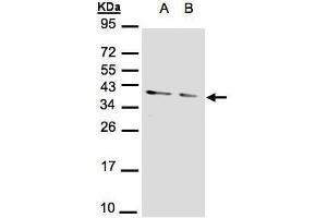WB Image Sample(30 μg of whole cell lysate) A:293T B:A431, 12% SDS PAGE antibody diluted at 1:1000 (PPP1CA Antikörper  (Center))