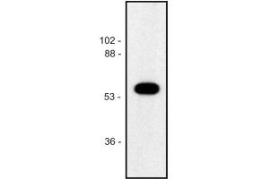 Western blot of human Jurkat T cell line (alpha Tubulin Antikörper)