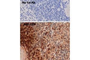 IHC of mouse spleen using anti-CD4 antibody and FFPE tissue after heat-induced antigen retrieval. (CD4 Antikörper)