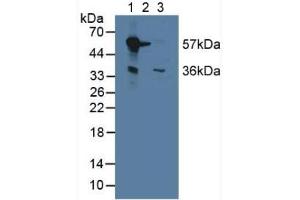 Western blot analysis of (1) Mouse Liver Tissue, (2) Mouse Brain Tissue and (3) Mouse Kidney Tissue. (Monoamine Oxidase B Antikörper  (AA 206-505))