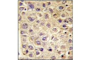 Immunohistochemistry (IHC) image for anti-TYRO3 Protein Tyrosine Kinase (TYRO3) antibody (ABIN356409) (TYRO3 Antikörper)