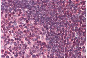 Human Small Intestine, Peyer's Patch (formalin-fixed, paraffin-embedded) stained with DAPK3 antibody ABIN214482 at 2. (DAPK3 Antikörper  (Internal Region))