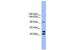 ENPP2 antibody used at 1 ug/ml to detect target protein.