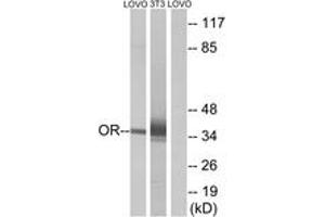 Western blot analysis of extracts from LOVO/NIH-3T3 cells, using OR4D6 Antibody.