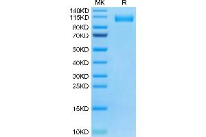 SARS-CoV-2 Spike S1 (Omicron BA. (SARS-CoV-2 Spike S1 Protein (BA.4 - Omicron, BA.5 - Omicron) (His tag))