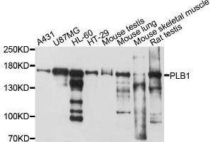 Western blot analysis of extracts of various cell lines, using PLB1 antibody (ABIN5998536) at 1/1000 dilution. (Phospholipase B Antikörper)