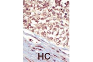 Immunohistochemistry (IHC) image for anti-EPH Receptor A5 (EPHA5) antibody (ABIN3003333) (EPH Receptor A5 Antikörper)