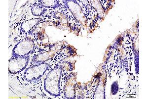 Formalin-fixed and paraffin embedded mouse colon labeled with Anti-Jagged1/CD339 Polyclonal Antibody, Unconjugated (ABIN686677) at 1:200 followed by conjugation to the secondary antibody and DAB staining. (JAG1 Antikörper)