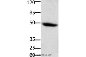 Western blot analysis of Mouse heart tissue, using CSF2RA Polyclonal Antibody at dilution of 1:400
