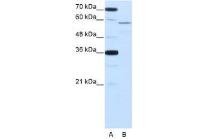 NOVA2 antibody used at 2. (NOVA2 Antikörper  (Middle Region))