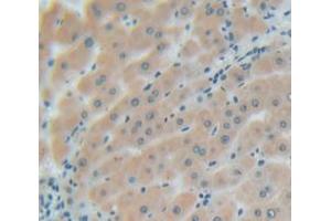 IHC-P analysis of Human Tissue, with DAB staining. (Glypican 3 Antikörper  (AA 343-559))