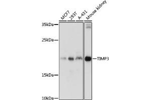 Western blot analysis of extracts of various cell lines, using TIMP3 antibody (ABIN6134857, ABIN6149180, ABIN6149181 and ABIN6215546) at 1:1000 dilution. (TIMP3 Antikörper  (C-Term))