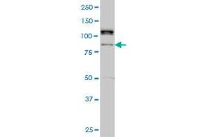 ALS2CR8 monoclonal antibody (M01), clone 2A3 Western Blot analysis of ALS2CR8 expression in Hela S3 NE . (Calcium Responsive Transcription Factor (CARF) (AA 621-718) Antikörper)