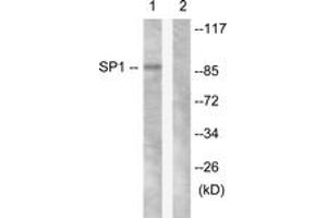 Western blot analysis of extracts from LOVO cells, using SP1 (Ab-453) Antibody. (SP1 Antikörper  (AA 421-470))