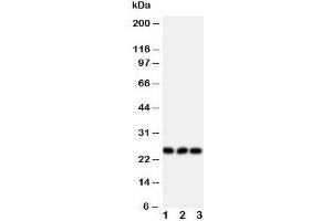 Western blot testing of FGF19 antibody and Lane 1:  rat brain;  2: U87;  3: SMMC-7721 cell lysate