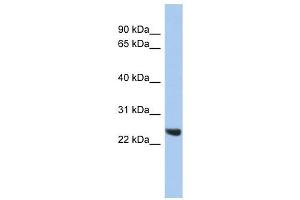 PSMB2 antibody used at 1 ug/ml to detect target protein. (PSMB2 Antikörper)