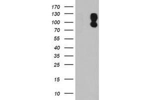 HEK293T cells were transfected with the pCMV6-ENTRY control (Left lane) or pCMV6-ENTRY DPP9 (Right lane) cDNA for 48 hrs and lysed. (DPP9 Antikörper)