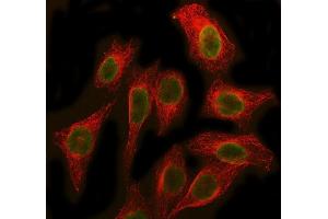 IF analysis of SBDS using anti-SBDS antibody (ABIN7600404) and anti-Beta Tubulin antibody (ABIN7602743). (SBDS Antikörper  (AA 19-241))