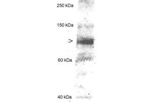 Western blot analysis of MLXIPL in 20 ug of human hepatocyte lysate using MLXIPL polyclonal antibody . (MLXIPL Antikörper  (AA 800-852))