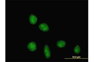 Immunofluorescence of purified MaxPab antibody to TRIM28 on HeLa cell. (KAP1 Antikörper  (AA 1-835))