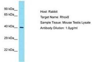 Image no. 1 for anti-Reproductive Homeobox 8 (RHOX8) (N-Term) antibody (ABIN6750248) (RHOX8 Antikörper  (N-Term))