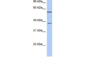 NUP43 antibody used at 1 ug/ml to detect target protein. (NUP43 Antikörper  (Middle Region))