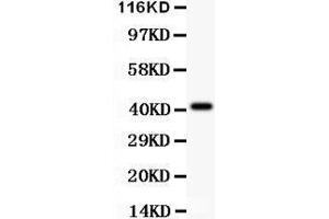 Anti- EDA antibody, Western blotting All lanes: Anti EDA  at 0. (Ectodysplasin A Antikörper  (AA 30-391))