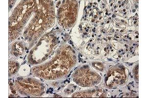 Immunohistochemical staining of paraffin-embedded Human Kidney tissue using anti-CAT mouse monoclonal antibody. (Catalase Antikörper)