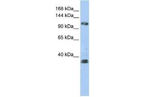 WB Suggested Anti-ZEB2 Antibody Titration:  0. (ZEB2 Antikörper  (N-Term))
