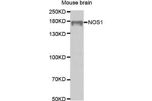 Western Blotting (WB) image for anti-Nitric Oxide Synthase 1, Neuronal (NOS1) (AA 1-180) antibody (ABIN6218566) (NOS1 Antikörper  (AA 1-180))