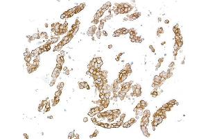 Immunocytochemistry (ICC) image for anti-Syndecan 1 (SDC1) (AA 23-251) antibody (ABIN7795742)