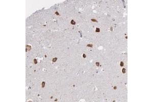 Immunohistochemical staining of human hippocampus with CTAGE5 polyclonal antibody  shows strong cytoplasmic positivity in neuronal cells. (MIA2 Antikörper)
