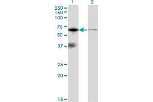 Western Blot analysis of EIF2AK2 expression in transfected 293T cell line by EIF2AK2 monoclonal antibody (M02), clone 1D11. (EIF2AK2 Antikörper  (AA 1-100))