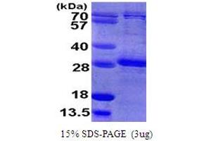 SDS-PAGE (SDS) image for Ras Homolog Gene Family, Member B (RHOB) (AA 1-193) protein (His tag) (ABIN667911)