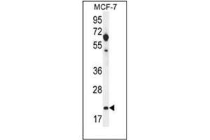 Western blot analysis of hCG_1646420 Antibody (Center) in MCF-7 cell line lysates (35ug/lane). (CLDN25 Antikörper  (Middle Region))