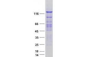 Validation with Western Blot