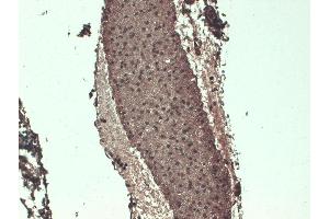 Immunohistochemistry analysis using Mouse Anti-Sodium Iodide Symporter Monoclonal Antibody, Clone 14F . (SLC5A5 Antikörper  (AA 468-643) (Atto 594))