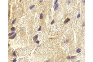 Immunohistochemistry of ECSIT in mouse heart cells with ECSIT antibody at 2 μg/ml. (ECSIT Antikörper  (C-Term))