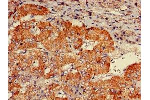 IHC image of ABIN7146261 diluted at 1:600 and staining in paraffin-embedded human adrenal gland tissue performed on a Leica BondTM system. (CHP Antikörper  (AA 2-195))