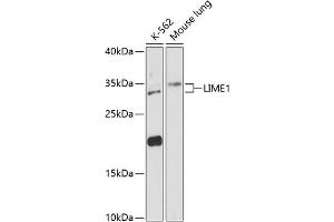 Western blot analysis of extracts of various cell lines, using LIME1 antibody (ABIN6128200, ABIN6143228, ABIN6143229 and ABIN6217817) at 1:3000 dilution. (LIME Antikörper  (AA 1-295))