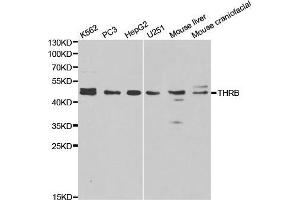 Western blot analysis of extracts of various cell lines, using THRB antibody. (THRB Antikörper  (AA 1-250))