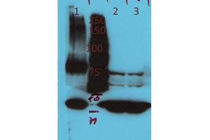 Western Blotting (WB) image for anti-ArfGAP with GTPase Domain, Ankyrin Repeat and PH Domain 4 (AGAP4) antibody (ABIN5596983)