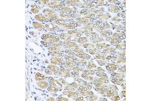 Immunohistochemistry of paraffin-embedded mouse stomach using R antibody (ABIN3021523, ABIN3021524, ABIN3021525 and ABIN6215193) at dilution of 1:100 (40x lens).