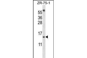 SUMO1 Antibody (N-term) (ABIN657634 and ABIN2846630) western blot analysis in ZR-75-1 cell line lysates (35 μg/lane). (SUMO1 Antikörper  (N-Term))