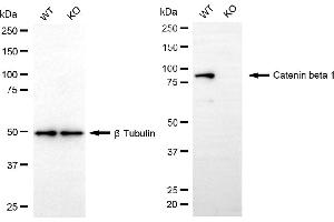 Western blotting analysis using catenin beta 1 antibody (ABIN7797930).